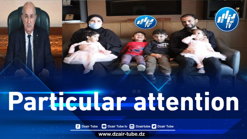 After the intervention of President Tebboune, Algerian Siamese twins successfully separated and enjoy special attention in Turkey