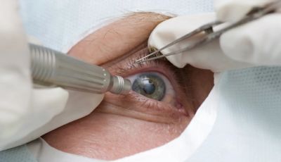 Algeria to Launch Corneal Transplant Program from Deceased Donors