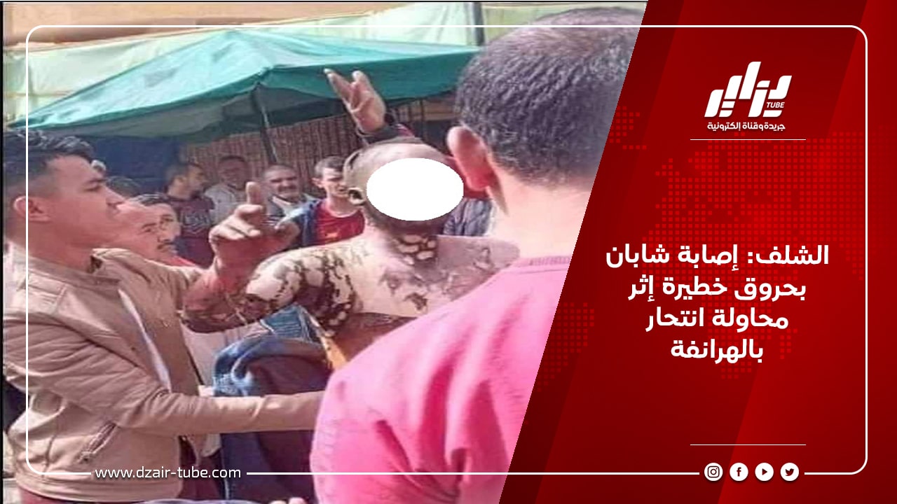 الشلف: إصابة شابان بحروق خطيرة إثر محاولة انتحار بالهرانفة