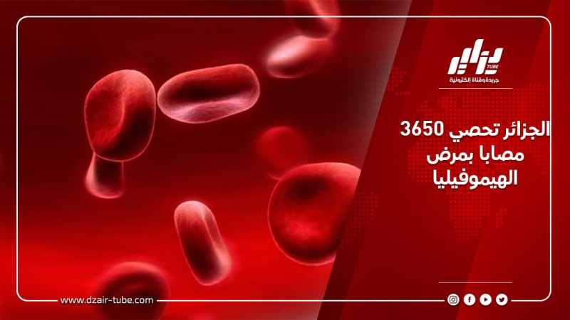 الجزائر تحصي 3650 مصابا بمرض الهيموفيليا