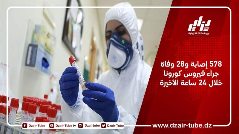 578 إصابة و28 وفاة جراء فيروس كورونا خلال 24 ساعة الأخيرة