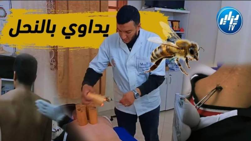 بالفيديو…شاهد يستعمل “سم النحل” والتدليك الصيني”.. هكذا يعالج أبو عبد الرحمان مرضى الروماتيزم والمفاصل