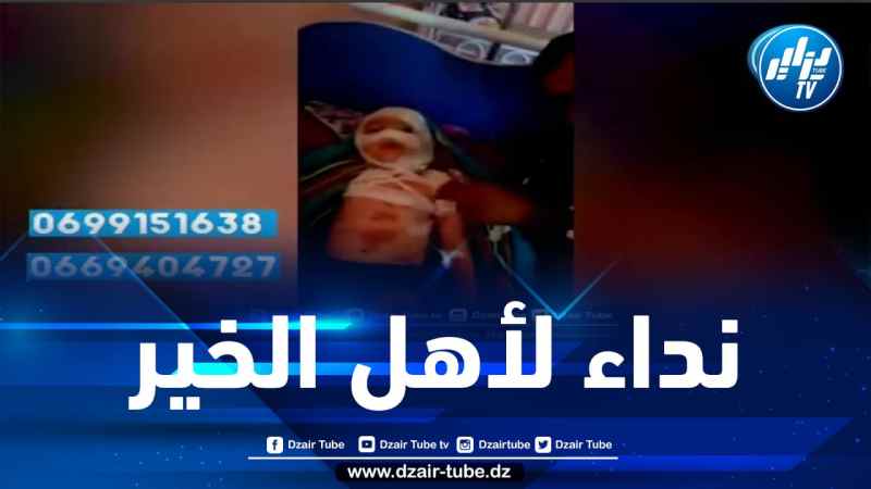 شااهد..نداء لذوي القلوب الرحيمة ..ساعدوا الملاك الصغير “جود “مصاب بمرض جلدي نادر  من ولاية سكيكدة ..جسمه يحترق   متواجد بالعناية المشددة و حالته جد حرجة ..يعاني و يطلب المساعدة يا أهل الجزائر الأحرار رقم الهاتف الخاص بأب الطفل :” 0669404727″