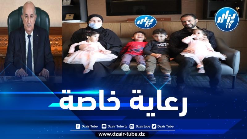 بعد تدخل الرئيس تبون… التوأم السيامي الجزائري يحظى بعناية خاصة في تركيا وعملية فصله تكلل بالنجاح