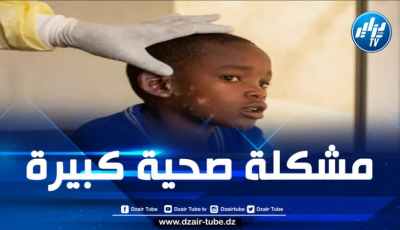الاتحاد الإفريقي يحذر من تحول جدري القرود إلى وباء عالمي