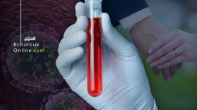 مصابون بالسّيدا يزوّرون تحاليل الدم لغرض الزواج!