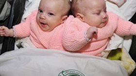 فصل التوأم الجزائري إكرام وسارة بالسعودية