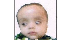 علاء الدين في حاجة إلى 50 مليونا للعلاج بتونس