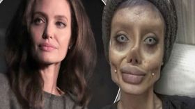 أرادت ان تشبه أنجلينا جولي وهذا ما حلّ بها؟!