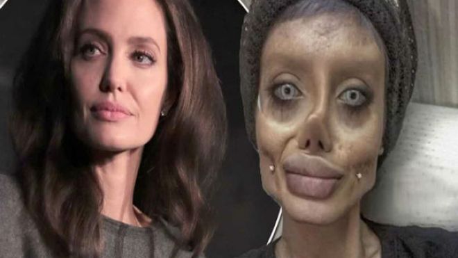 أرادت ان تشبه أنجلينا جولي وهذا ما حلّ بها؟!