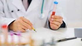 إصابة 5 أشخاص من عائلة واحدة بعدوى داء البريسيلوز بالبويرة