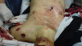 تحطم‭ ‬طائرة‭ ‬حربية‭ ‬كانت‭ ‬متوجهة‭ ‬لقصف‭ ‬بنغازي