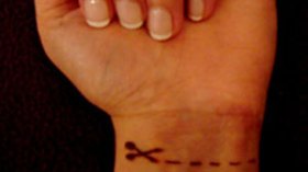 تلميذ كسر زجاج النافذة وقطّع شرايينه وآخر شرب ''روح الملح''