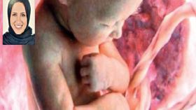 نورة البكيري.. السعودية التي توصلت لعلاج قلب الجنين بتقنية النانو