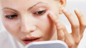 هكذا تتخلصين من الهالات السوداء؟!