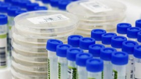 الجزائر تقلّص طلبية لقاح انفلونزا الخنازير