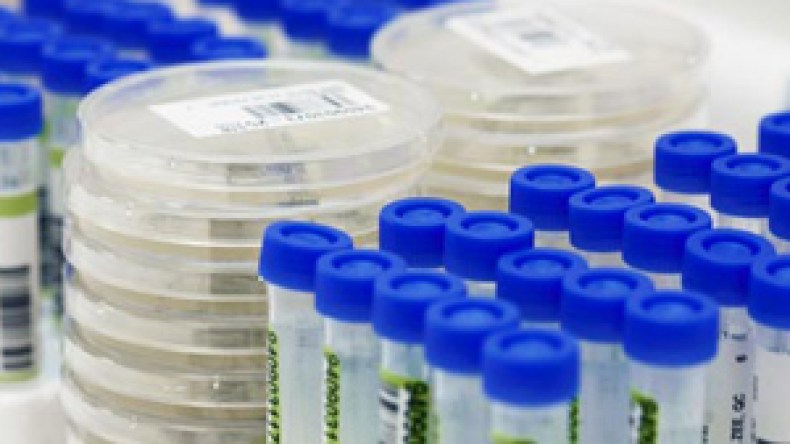 الجزائر تقلّص طلبية لقاح انفلونزا الخنازير