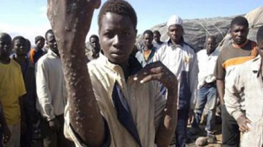 African illegal immigrants export eight killer diseases to Algerians