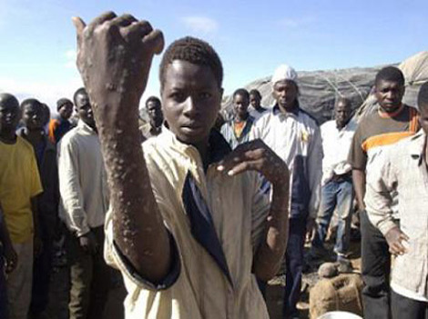 African illegal immigrants export eight killer diseases to Algerians