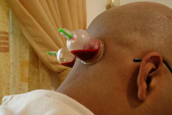 Boudiaf Declares War On Glass-Cupping and “Rokia” (“Spiritual Healing”) Shops