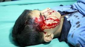 الشهداء والجرحى من الأطفال خلال العدوان الاسرائيلي على قطاع غزة