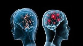 عقل المرأة قد يتفوق على عقل الرجل