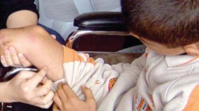 200 ألف مصاب بالسكري مهددون ببتر الأرجل