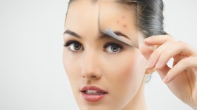 ‎نعيمة ميمون: ‎‫حب الشباب… حلول ونصائح حصرية