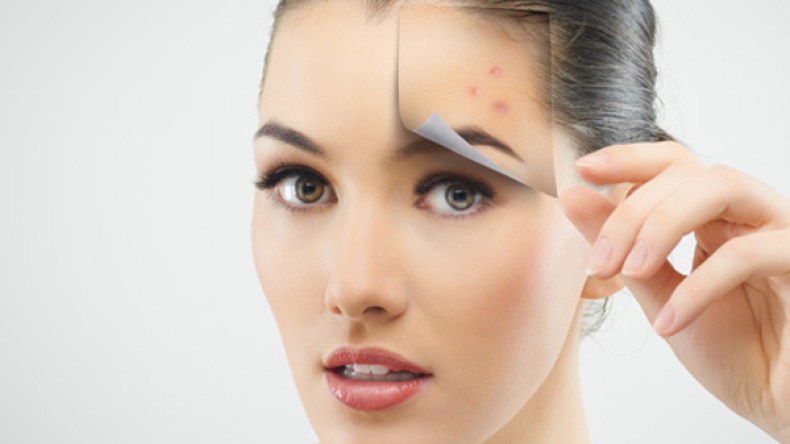 ‎نعيمة ميمون: ‎‫حب الشباب… حلول ونصائح حصرية