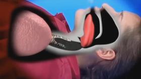 كيفية إنقاذ شخص بلع لسانه