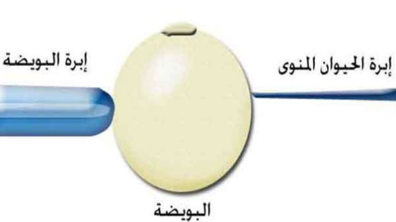 الحقن المجهري.. ميزاته وسلبياته