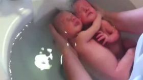 مشاعر قمة في الروعة.. توأمان يتعانقان أثناء الاستحمام