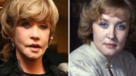 الممثلة الروسية فيرا ألينتوفا تخضع لعملية تجميل فاشلة!