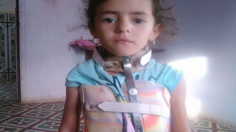 حزام حديدي يحول حياة الطفلة هدى إلى عذاب!