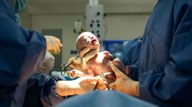 العمليات القيصرية لا تمنع الولادة الطبيعية اللاحقة