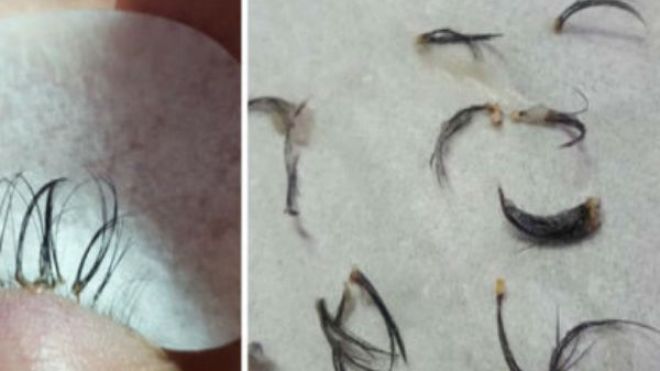 سيدة تفقد رموشها الطبيعية بعد تركيب رموش صناعية!