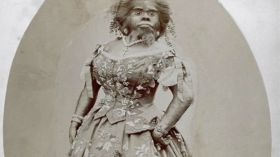 المرأة الغوريلا.. تزوجت من صاحب سيرك حنط جثتها بعد موتها!