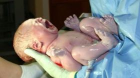 الولادة القيصرية ليست دائماً الخيار الوحيد