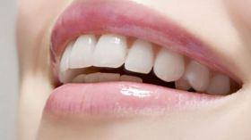 هكذا تستمتعين بابتسامة تعكس بياض أسنانك؟!