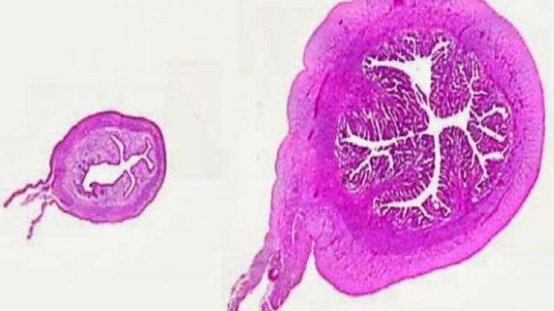 تعرفي على علاج صغر حجم البويضة