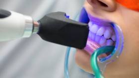 جزائريون من الإبتسامة الهوليودية إلى فقدان الأسنان