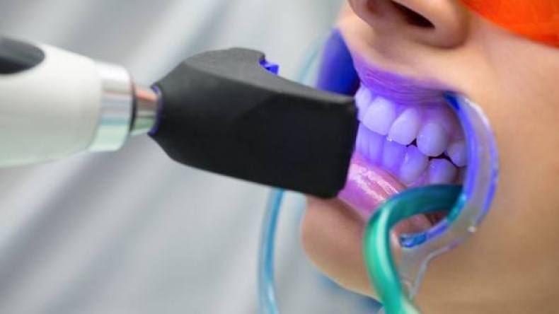 جزائريون من الإبتسامة الهوليودية إلى فقدان الأسنان