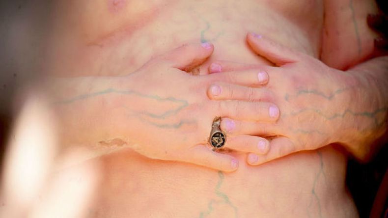 ترامب “عاريا” في متنزه بنيويورك!