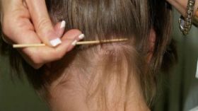 القملة ب 14 درهما في دبي.. والسبب؟!