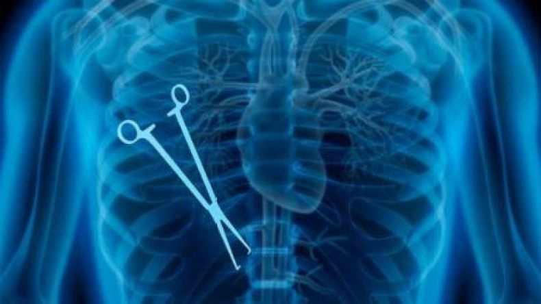 أطباء ينسون شفرات جراحة ومِقاصَّ في بطون مرضاهم