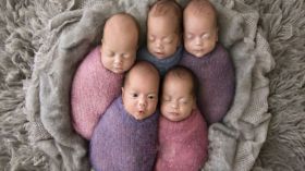 أسترالية أنجبت 5 توائم وأشرف على توليدها 50 طبيبا!