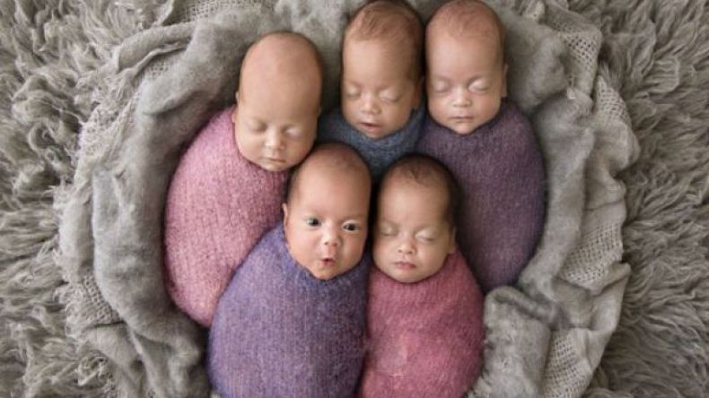 أسترالية أنجبت 5 توائم وأشرف على توليدها 50 طبيبا!