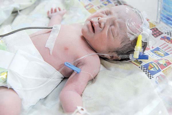 Carelessness kills 83 infants in hospital everyday