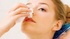 الرعاف خلال الصيف.. تعرفي على العلاج