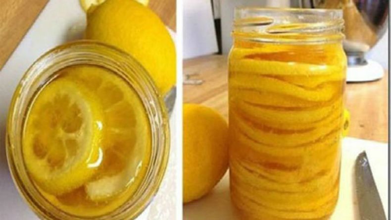 وصفة ألمانية لعلاج تصلب الشرايين وتحسين الجهاز المناعي